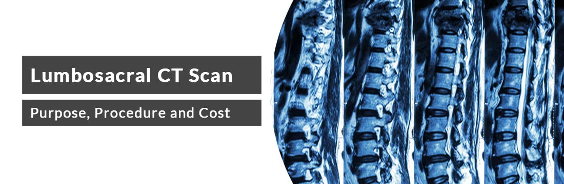 Lumbosacral CT Scan: Purpose, Procedure and Cost